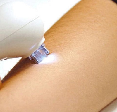 Depilação-a-lazer-Como-funciona-informações-1