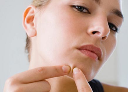 Sabonete-para-tratar-e-prevenir-acne-dicas