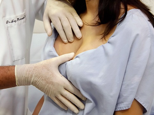 Implantes-de-silicone-preco-medio-2