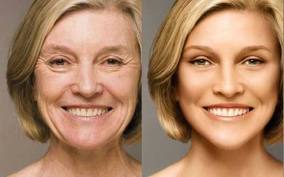 Dicas para retardar o envelhecimento da pele