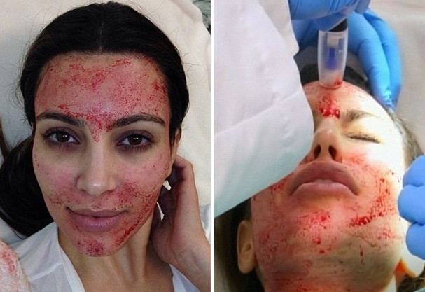 Tratamentos excêntricos para Beleza feminina