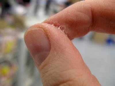 Como remover super bonder da pele