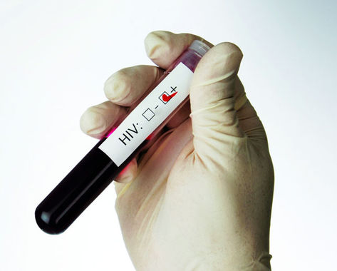 Exame de sangue contra Aids (Foto: Divulgação)