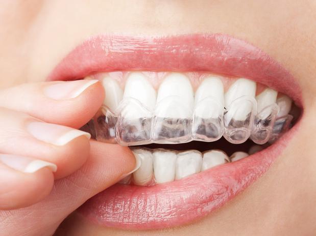 Cuide dos dentes (Foto: Divulgação)