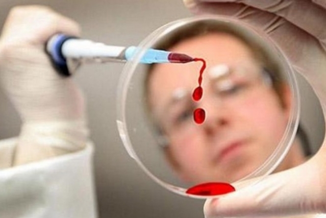 Novidades sobre o teste de HIV (Foto: Divulgação)