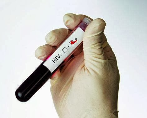Aprenda a fazer o teste de HIV (Foto: Divulgação)